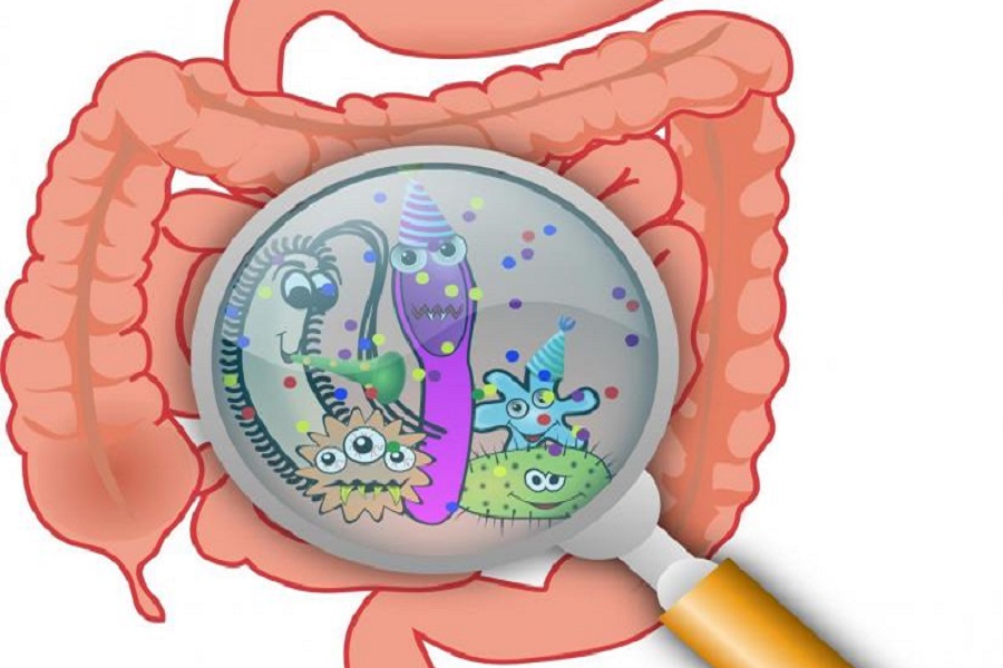 Gut microbiome changes may signal onset of rheumatoid arthritis