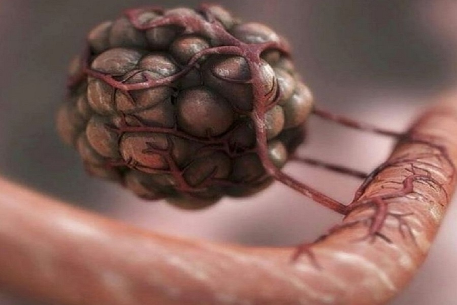 Researchers find genetic fingerprints to predict efficacy of immunotherapy