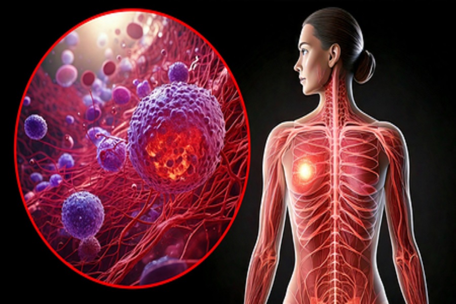 BMI may influence breast cancer risk in women with heart disease: WHO study