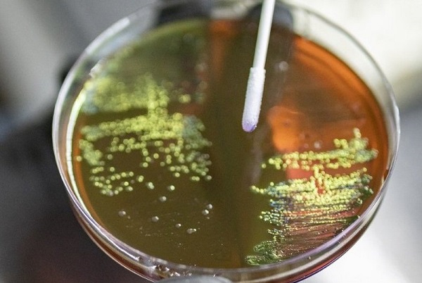 High superbug load in Delhi environment posing public health risks