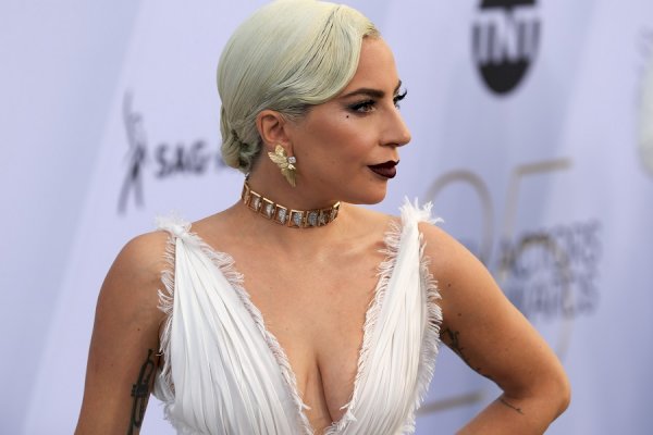 Lady Gaga: I'm perfectly imperfect