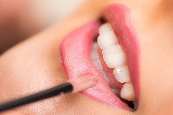 7 important questions to ask your dental implant dentist