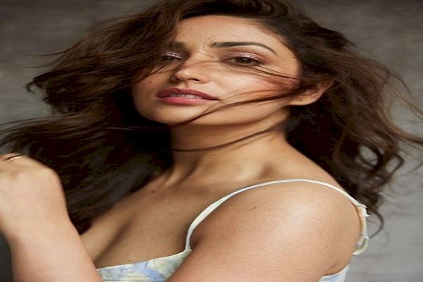 Yami Gautam reveals she suffers from skin condition called Keratosis pilaris