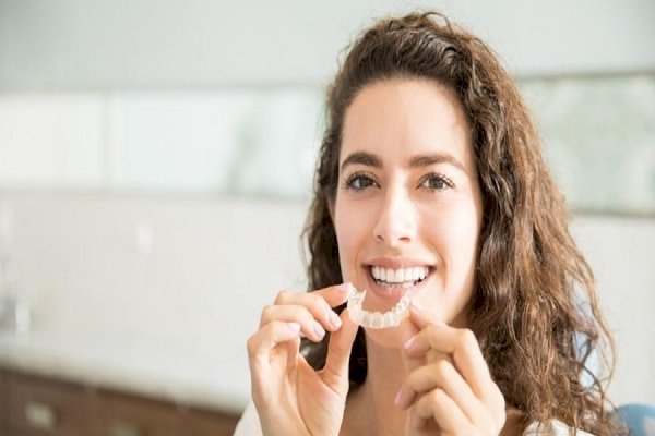 Busting myths around aligners and braces