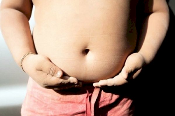 Obese children more likely to develop immune-related diseases