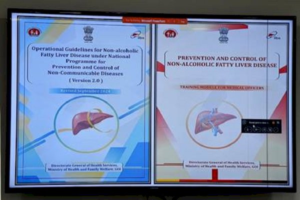 Union Health Ministry releases new guidelines for non-alcoholic fatty liver disease