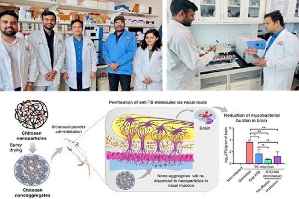 New nasal drug delivery method can reduce TB bacteria in brain by 1,000x