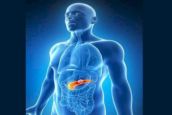 Most people unaware obesity can raise 20pc lifetime risk of pancreatic cancer