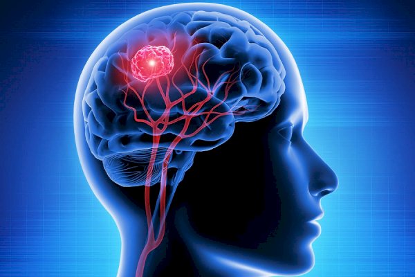 Men 3x more likely to die from a brain injury