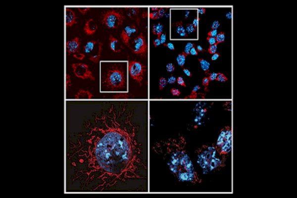 Study decodes why promising cancer treatments trigger serious side effects