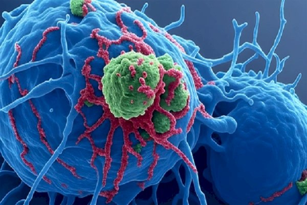 Hyaluronic acid may help improve gynaecological cancer treatment: Study