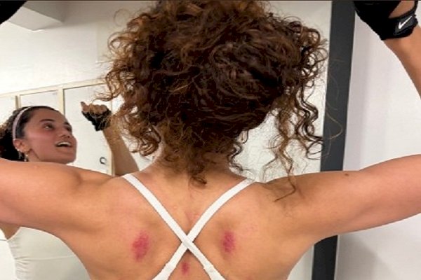 Taapsee Pannu shares glimpse of bruised back after working out on rough floor