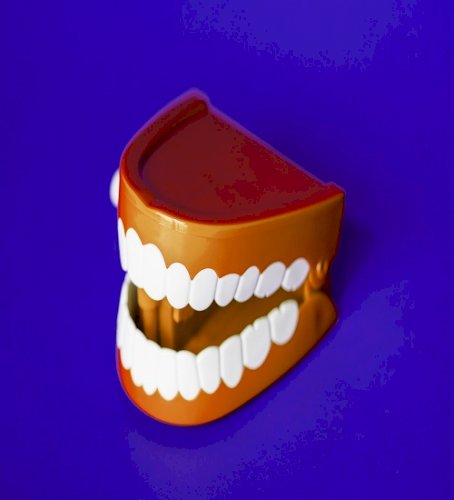 Study links bacterium lurking in gums with heart rhythm disorder