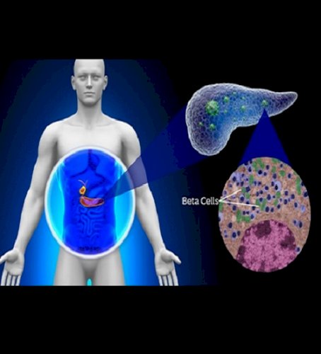 IIT Bombay study finds protein abundant in human body worsening diabetes