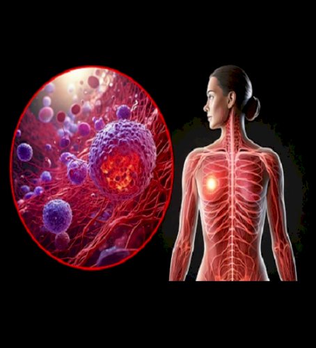 BMI may influence breast cancer risk in women with heart disease: WHO study