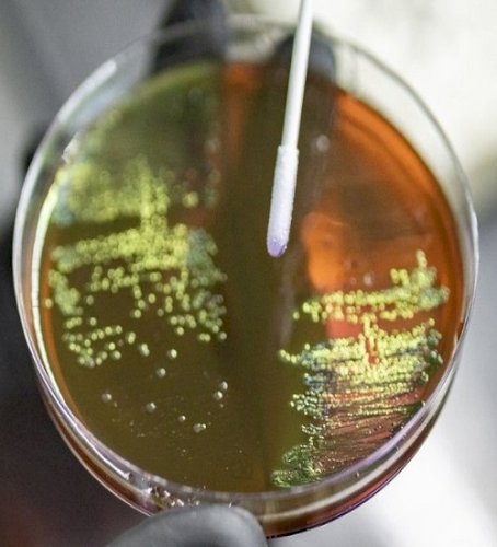 High superbug load in Delhi environment posing public health risks