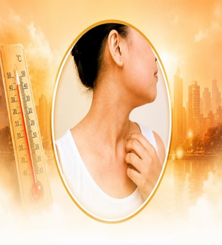 Skin problems can be dangerous in summer; recognize the symptoms early and take precautions like this.